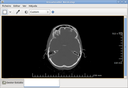 Linux: Visualizando exames médicos formato DICOM com Aeskulap